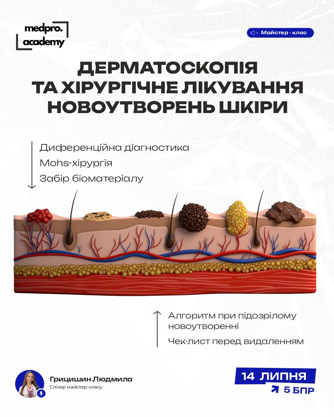 3Дерматоскопія та хірургічне лікування новоутворень шкіри міждисциплінарний підхід